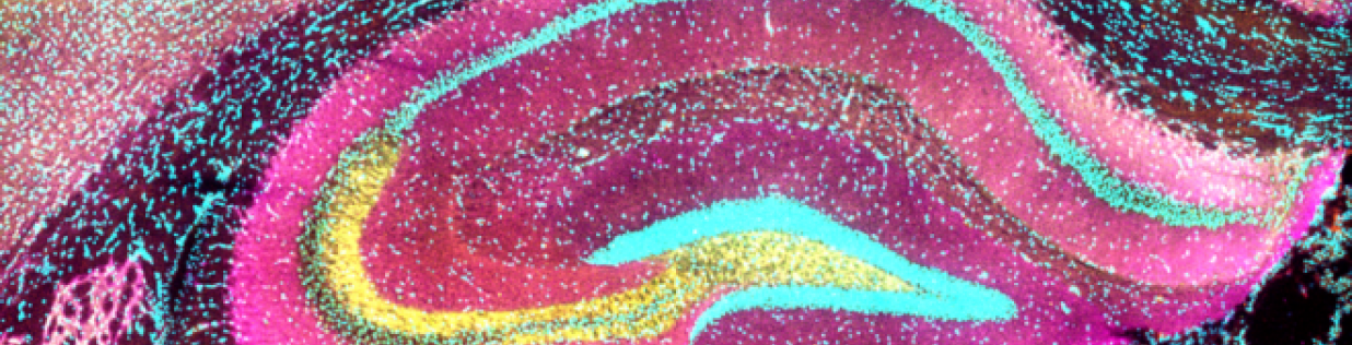Microscopic image of a section of the hippocampus, a part of the brain involved in memory. The yellow zone contains the synaptic connections where Tau and Synaptogyrin-3 are enriched. Copyright: Largo Barrientos