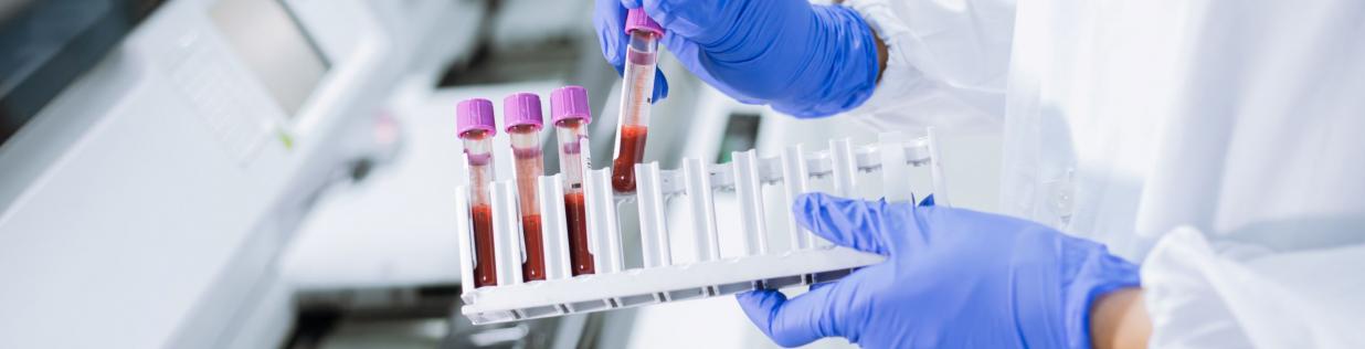 blood samples scientist lab