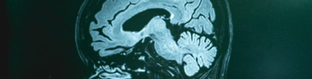 Brain scan - source: Shutterstock
