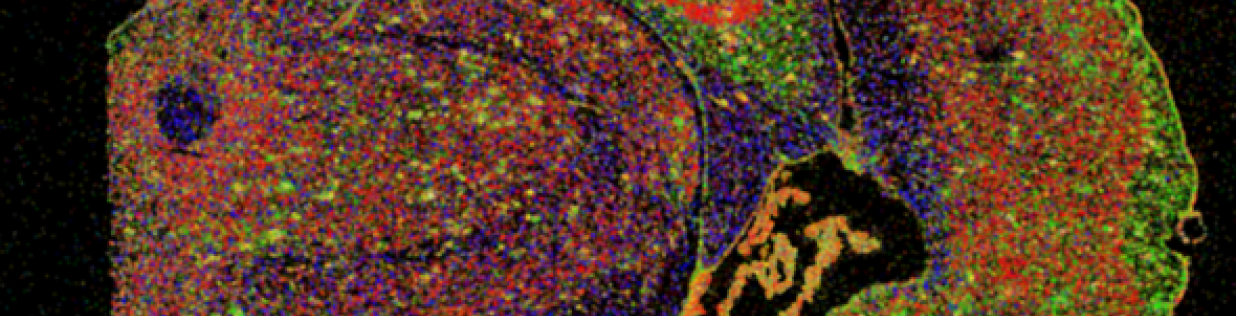  A section of half a mouse brain in which different types of brain cells are stained