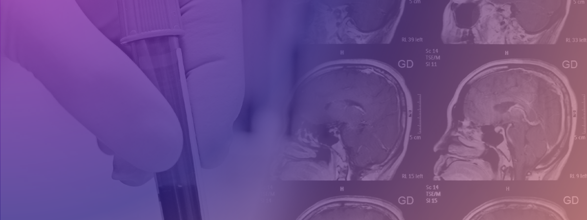 blood test for alzheimer's detection